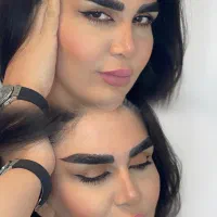 فیبروز به سبک میکروکاشت فقط 3 روز تخفیف ویژه