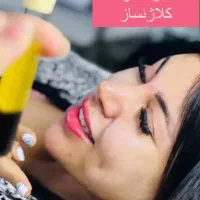 پی آر پی صورت‌ مو با کیت ویژه،،پلاسما ژل،خالبرداری