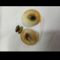 اصل سنگ مهره