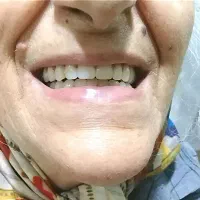 لابراتوار دندان مصنوعی