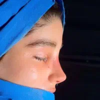 جراحی رینو پلاستی (بینی)