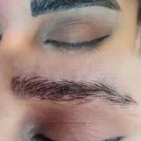 ریموو تتو صورت