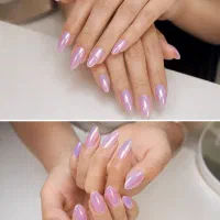 کاشت ترمیم لمینت ژلیش