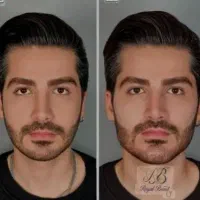 مدل