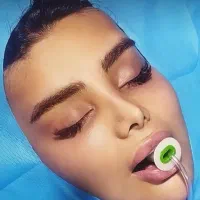 جراحی لیفت صورت (مکس لیفت)