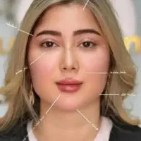 بوتاکس
