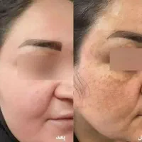 لک صورت اذیتت میکنه