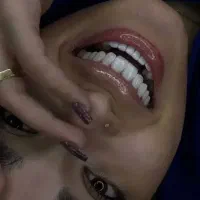 افر ویژه ونیرکامپوزیت فقط فکی ۳/۹۵۰