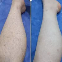 خدمات اپلاسیون