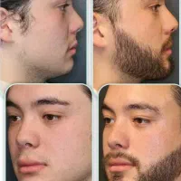 تو فاصله کمی تا جذابیتت داری