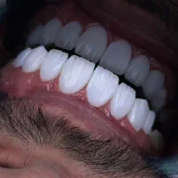 دستیار دندانپزشکی با سابقه در محدوده جردن