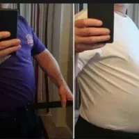 لاغری  بدون بازگشت و عوارض
