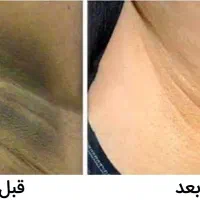 کرم رفع تیرگی+ترکیبات خارجی اصل+تضمین برگشت پول