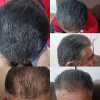 سبوس برنج بخور حله