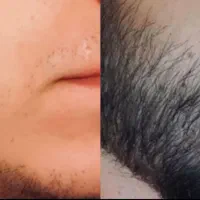 جای خالی با گزینه مناسب پر میشه