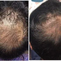 کاشتم بهت نتیجه نداد
