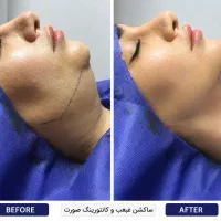 جشنواره تخفیفات 50٪عمل های زیبایی جانمونی
