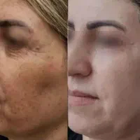 نسل جدید جوانساز