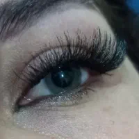 کاشت مژه