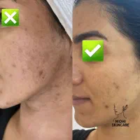 کلینیک تخصصی پاکسازی و فیشال پوست (بجنورد ،جاجرم)