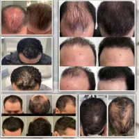 دور کم‌پشتی رو خط بکش