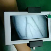 رگ یاب حرفه ای