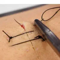 آموزش خصوصی و مجازی وصل سرم و بخیه
