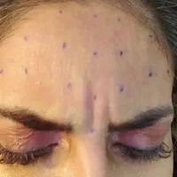 آموزش فول فیس و بوتاکس