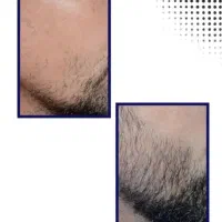 تا ۱۰۰سال موهاتو پرپشت نگه دار