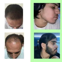 درخشش خیره‌کننده موها تنها با یک مرحله