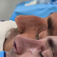 عمل زیبایی  بینی بابهترین کیفیت و هزینه مناسب