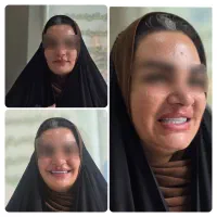 ساخت تخصصی پروتز متحرک(دندان مصنوعی)