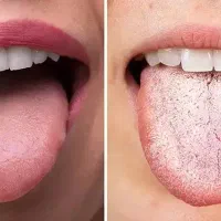 تشخیص و درمان ریشه ای بیماری‌ها