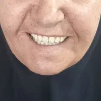 ساخت و ترمیم کلیه پروتزهای متحرک و ثابت دندانی..
