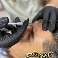 تزریق بوتاکس تخصصی با نتیجه طبیعی و اصلاح رایگان