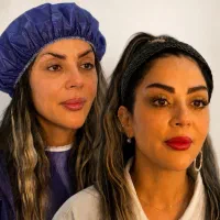 کاشت ابرو با اسکن ۳ بعدی