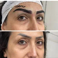 کاشت تخصصی ابرو - تخفیفی باور نکردنی در شیراز، خ قصرالدشت