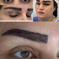 کاشت ابرو طبیعی