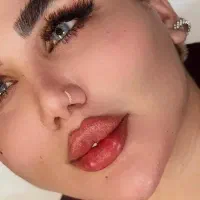 تزریق ژل بوتاکس آنزیم و آموزش در کلینیک