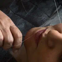 اصلاح صورت۱۰۰تومن