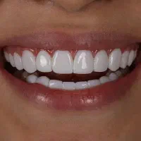 خدمات زیبایی دندان گلد دنت