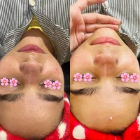 پاکسازی تخصصی و درما