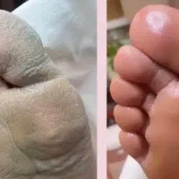 همکارمون شو تو لاین پدیکور و کفسابی تخصصی