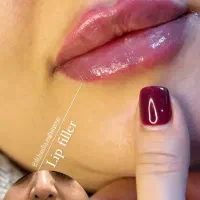 جشنواره فیلر و بوتاکس و لیزر در کلینیک پزشکی
