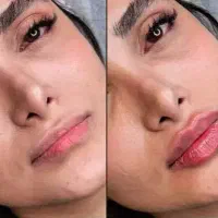 کلینیک زیبایی تزریق ژل و بوتاکس