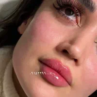 تزریق ژل و بوتاکس و فول فیس
