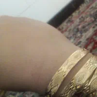 طلا