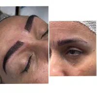 کاشت ابرو با شرایط استثنایی