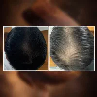 شونه تو موهات گیر میکنه