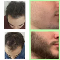 یک قدم تا خوش استایلی
